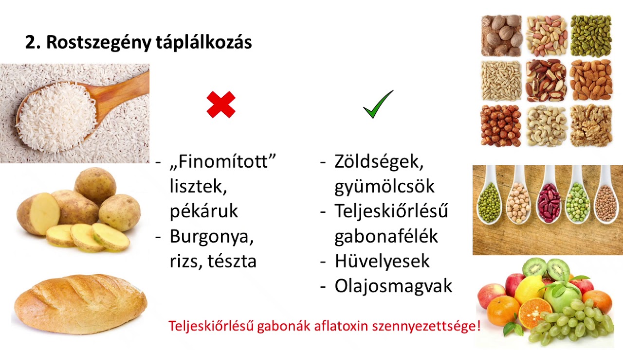 A vastagbéldaganatok megelőzése. Egy dietetikus szemével (Kovács Éva dietetikus)