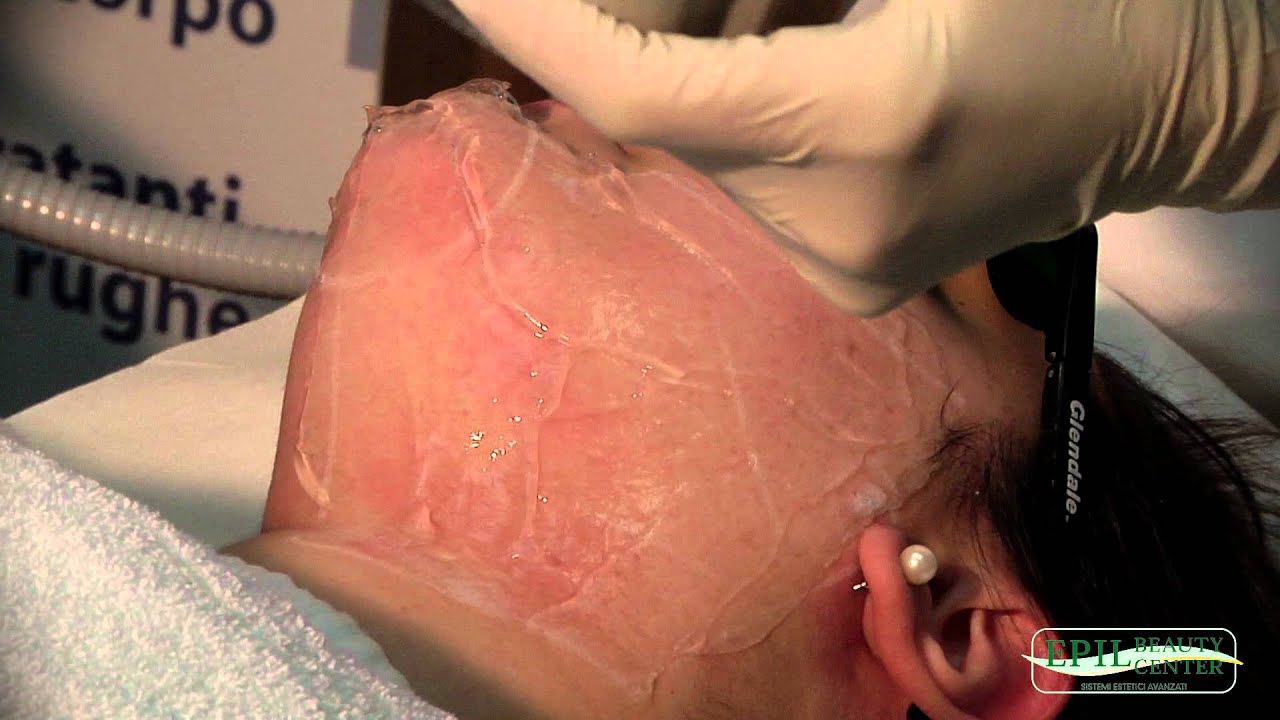 LUCE PULSATA VISO Epilbeauty Tel. 0541.78.78.08