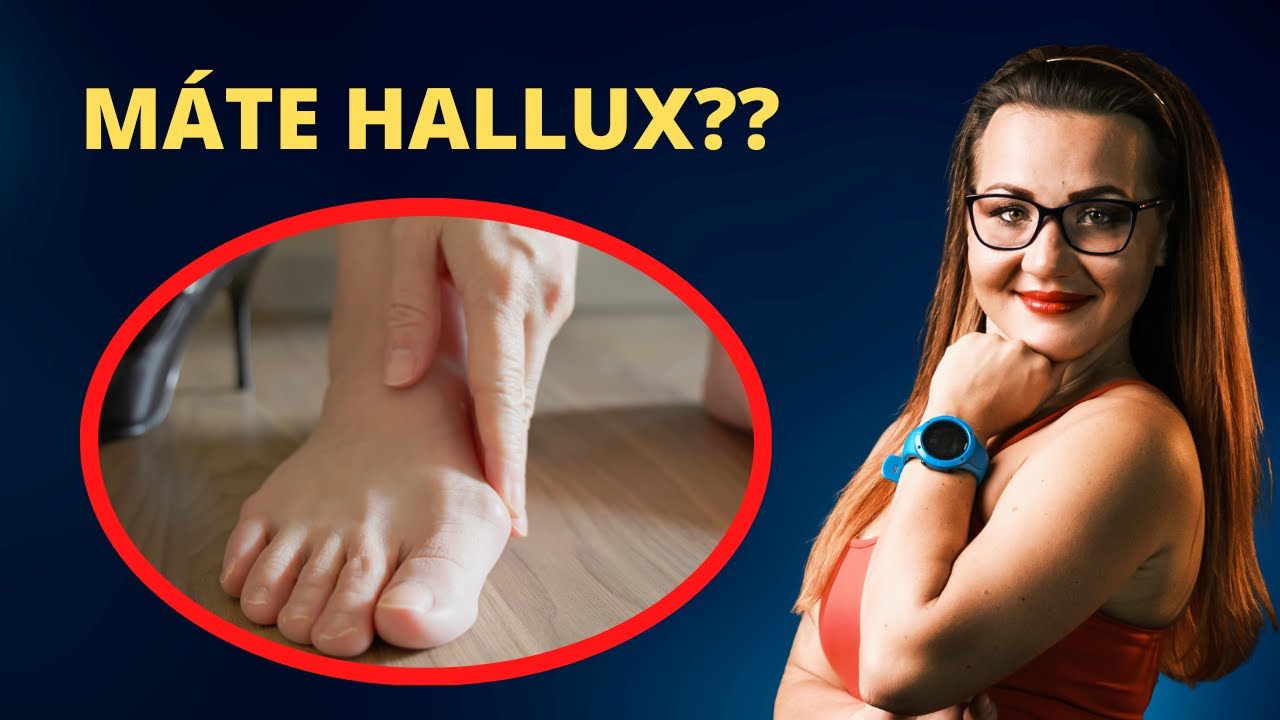 HALLUX - VBOČENÝ PALEC - JAK CVIČIT VBOČENÝ PALEC #pohyb #fyzioterapie #hallux #noha  #palec