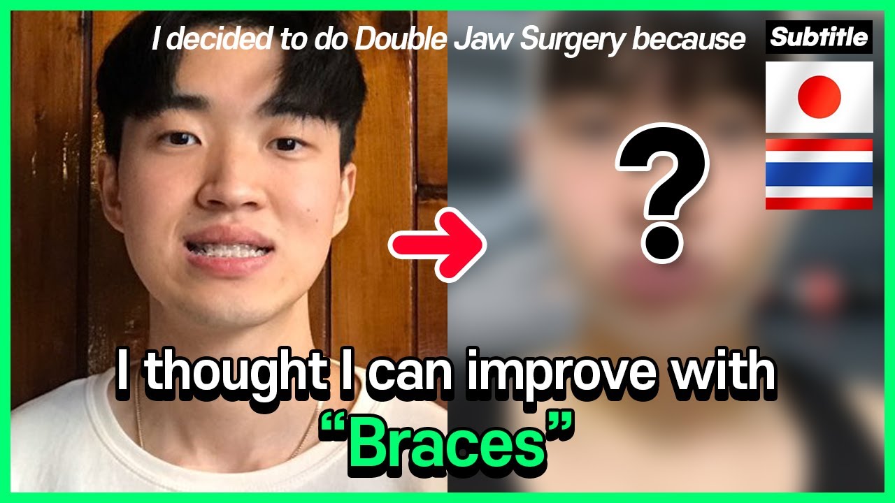 [EN/JP/TH SUB] I decided to do double jaw surgery because... 両顎手術 輪郭手術 l Eu surgery