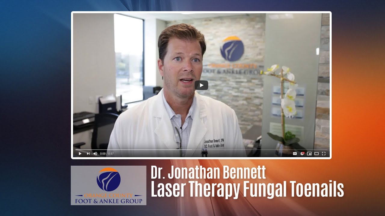 Laser Therapy for Fungal Toenails | Dr. Jonathan Bennett - OCfeet.com