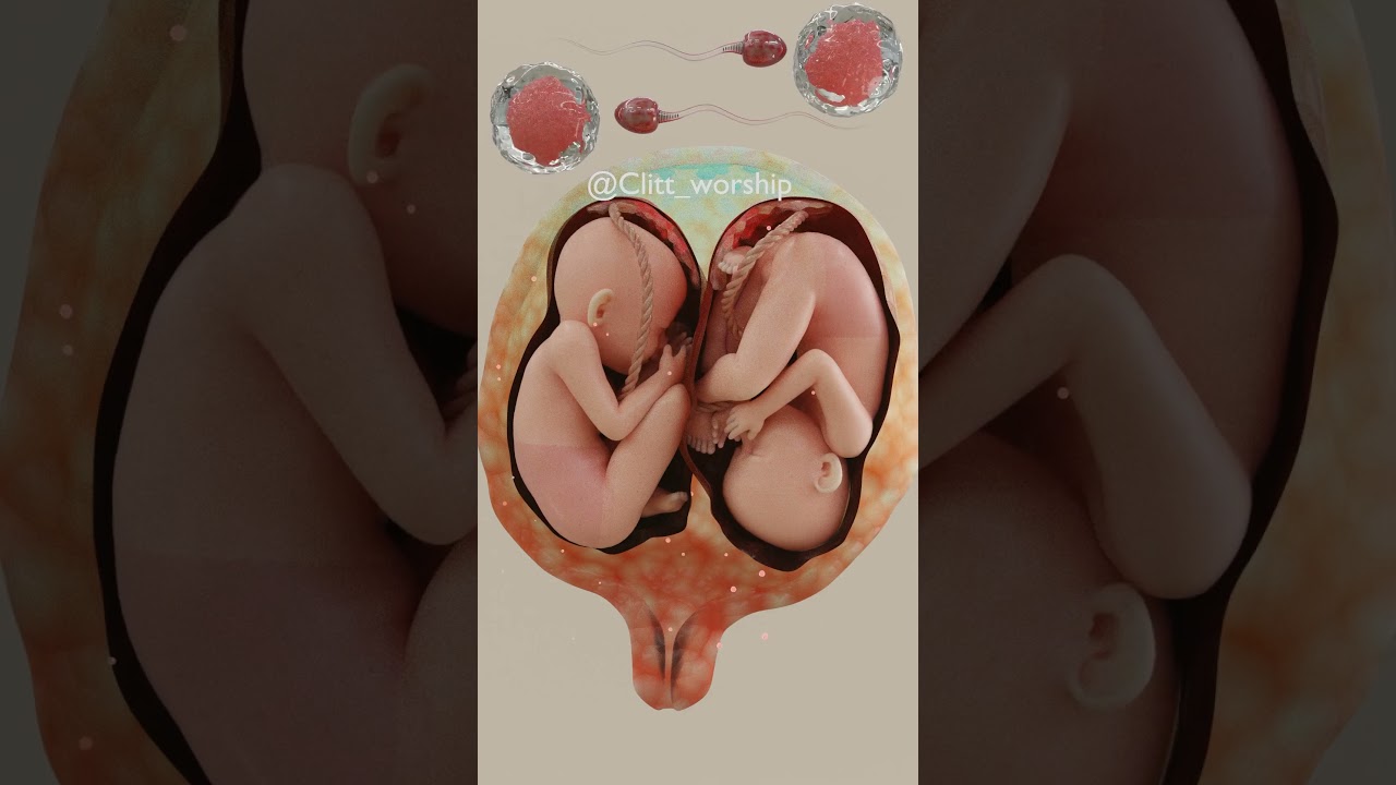 👶🏽👶🏽2 🥚&rsquo;s #twins #childbirth #pregnancy #g&ecirc;meos #gemelos #tvillingar