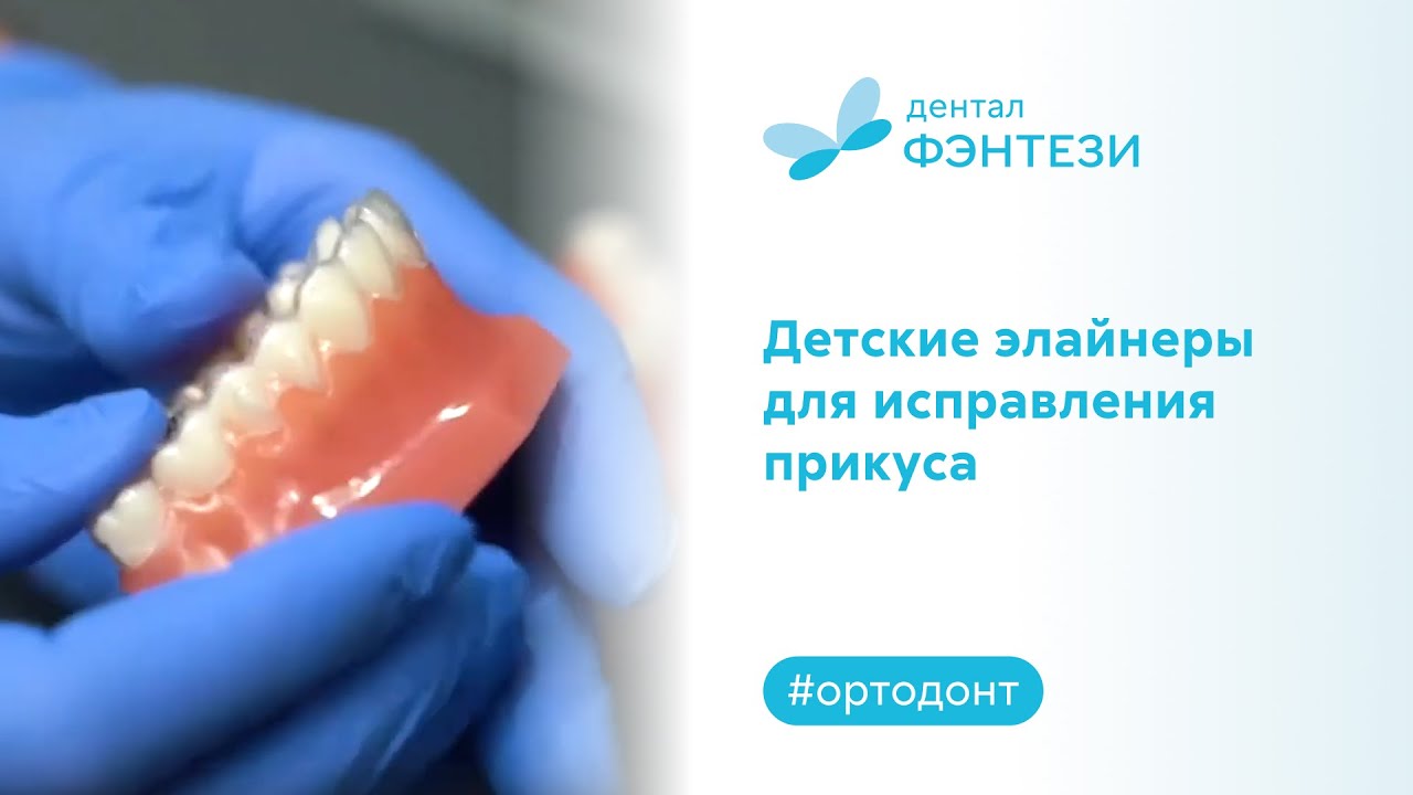 👦 Детские элайнеры для исправления прикуса