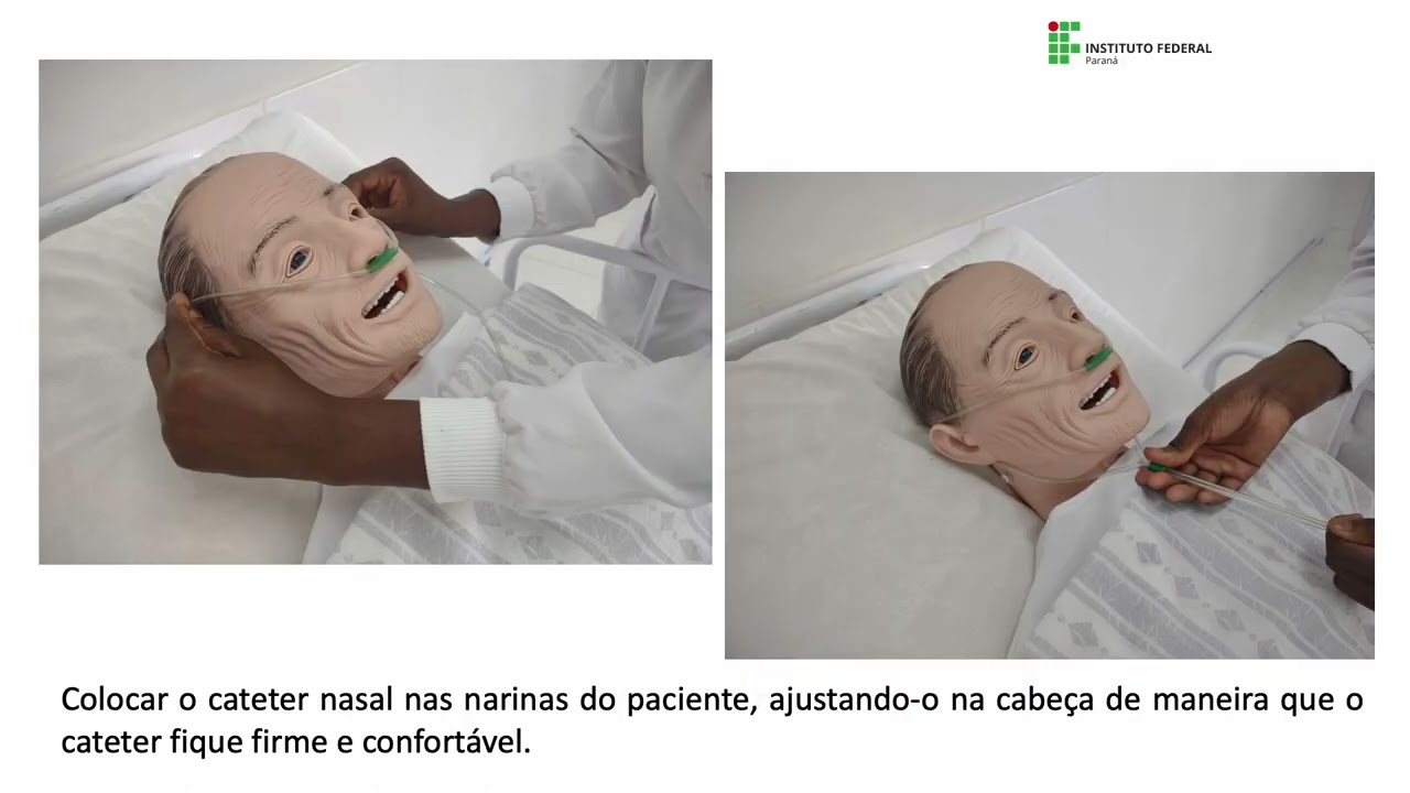 T&eacute;cnica de instala&ccedil;&atilde;o de cateter nasal tipo &oacute;culos