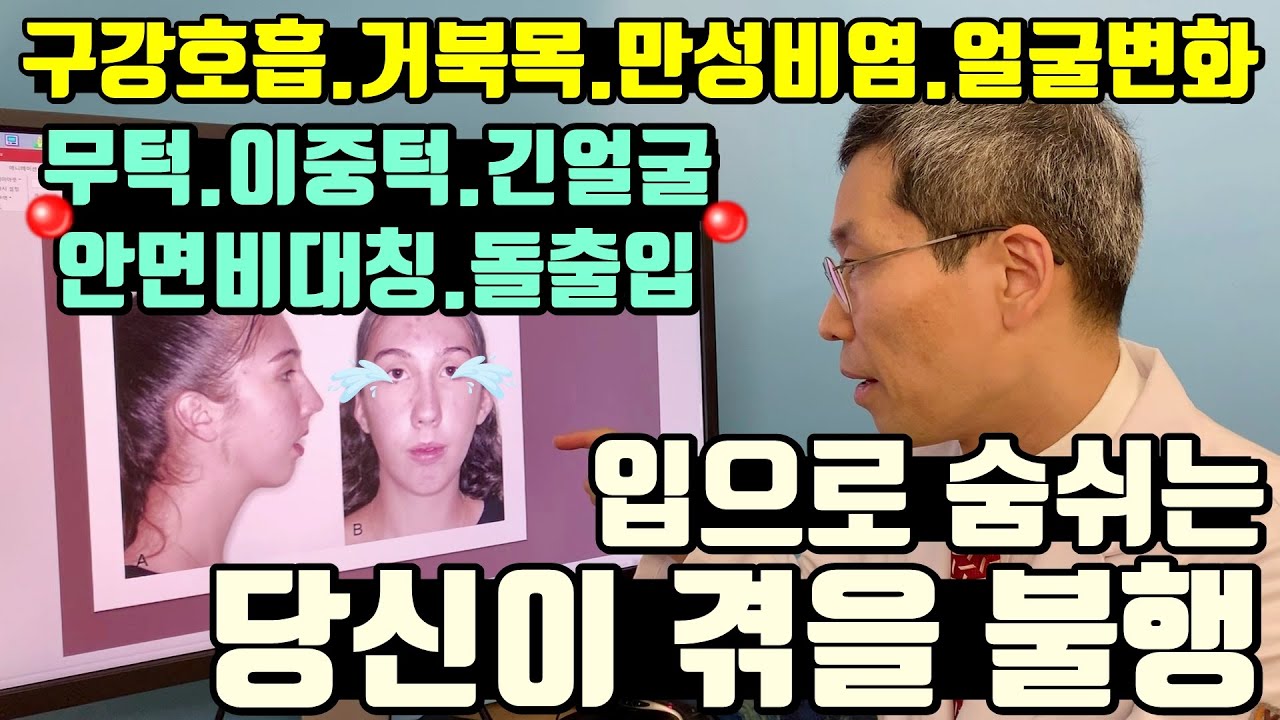 #구강호흡 ▶#거북목 ▶#개방교합 ▶#무턱 #이중턱 #안면비대칭 #돌출입 #아데노이드얼굴 😲정말??😲 #입으로호흡 했을 뿐인데... I #루이빈치과 류지헌 원장