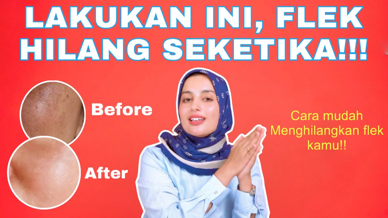 LAKUKAN INI, FLEK HILANG SEKETIKA!!!!!!!