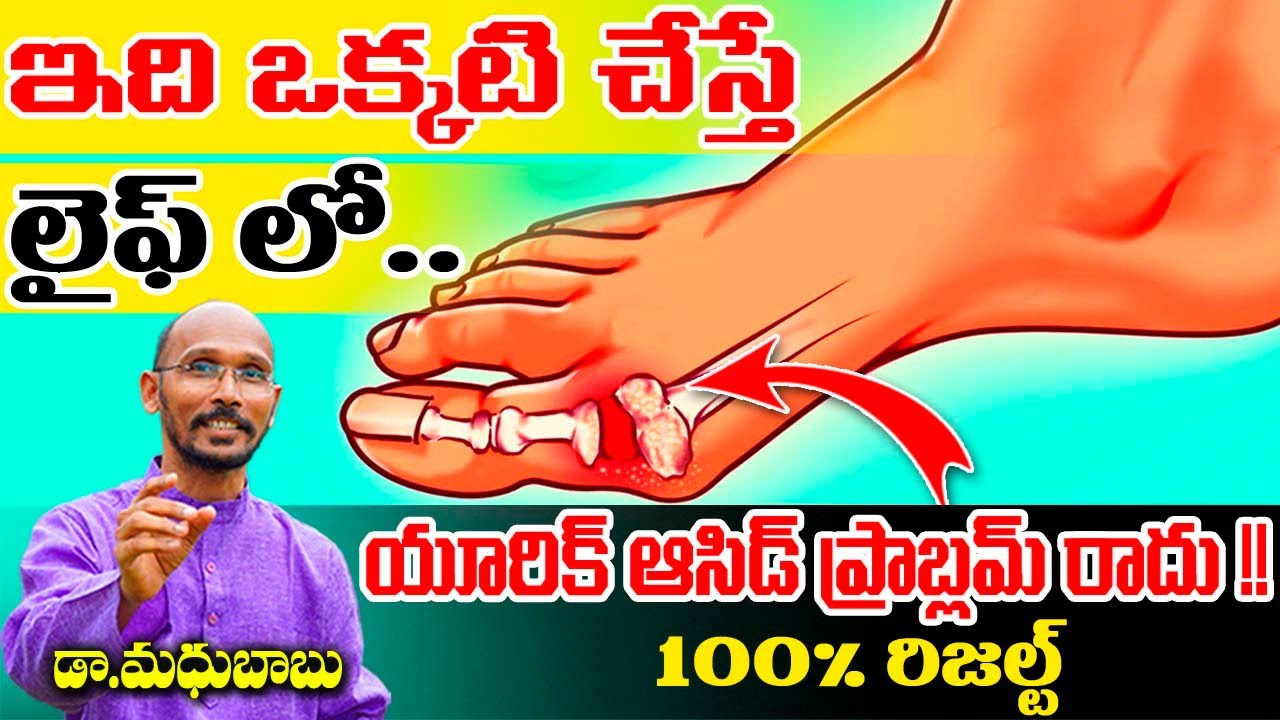ఇది ఒకటి చేస్తే లైఫ్ లో యూరిక్ ఆసిడ్ ప్రాబ్లమ్  రాదు !!| Dr. Madhu Babu | Health Trends |