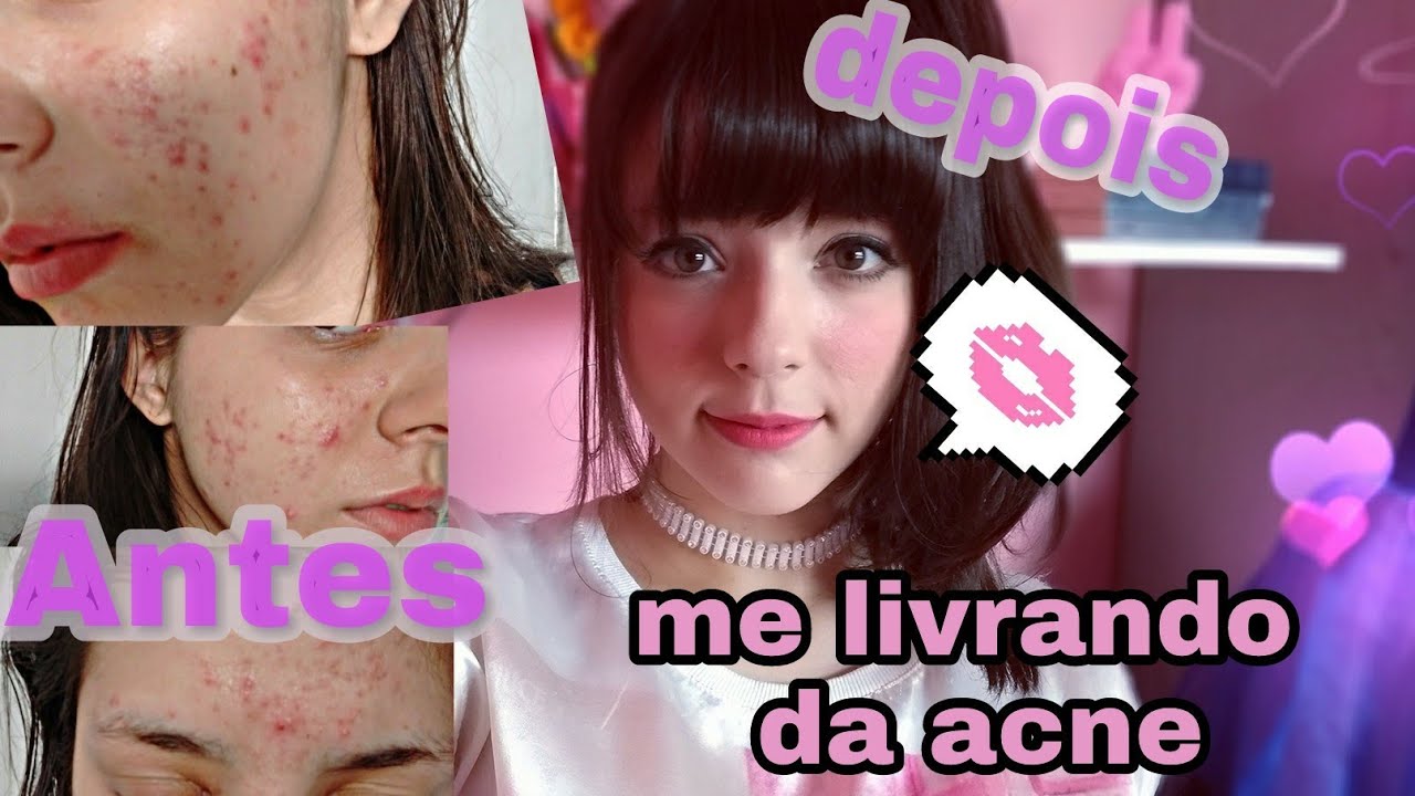 CUIDADOS KAWAI: Dicas de cuidados com a pele (♡˙︶˙♡)