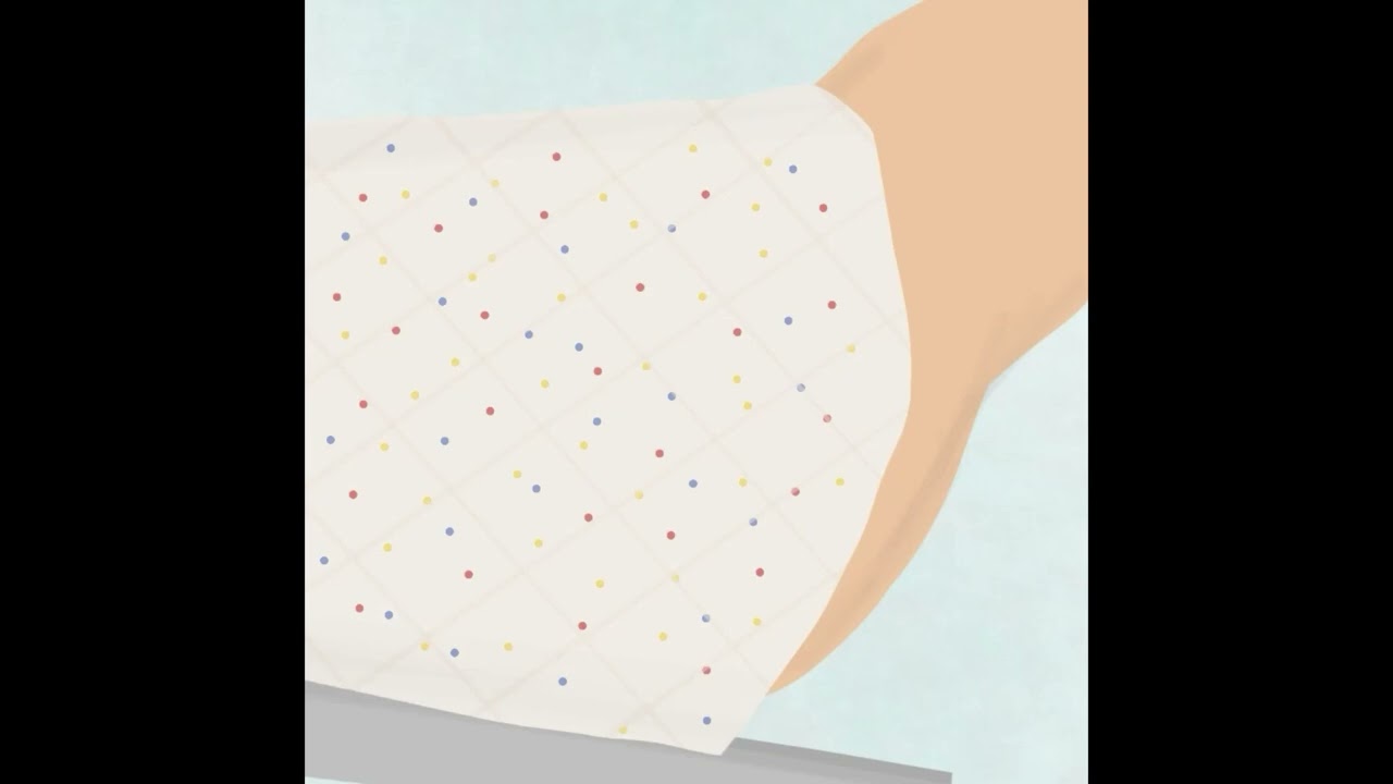 Prostate Biopsy