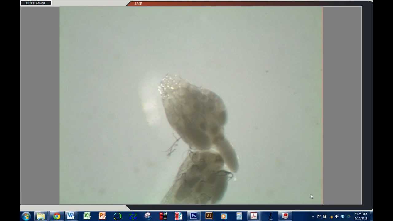 Drosophila Ovary Dissection