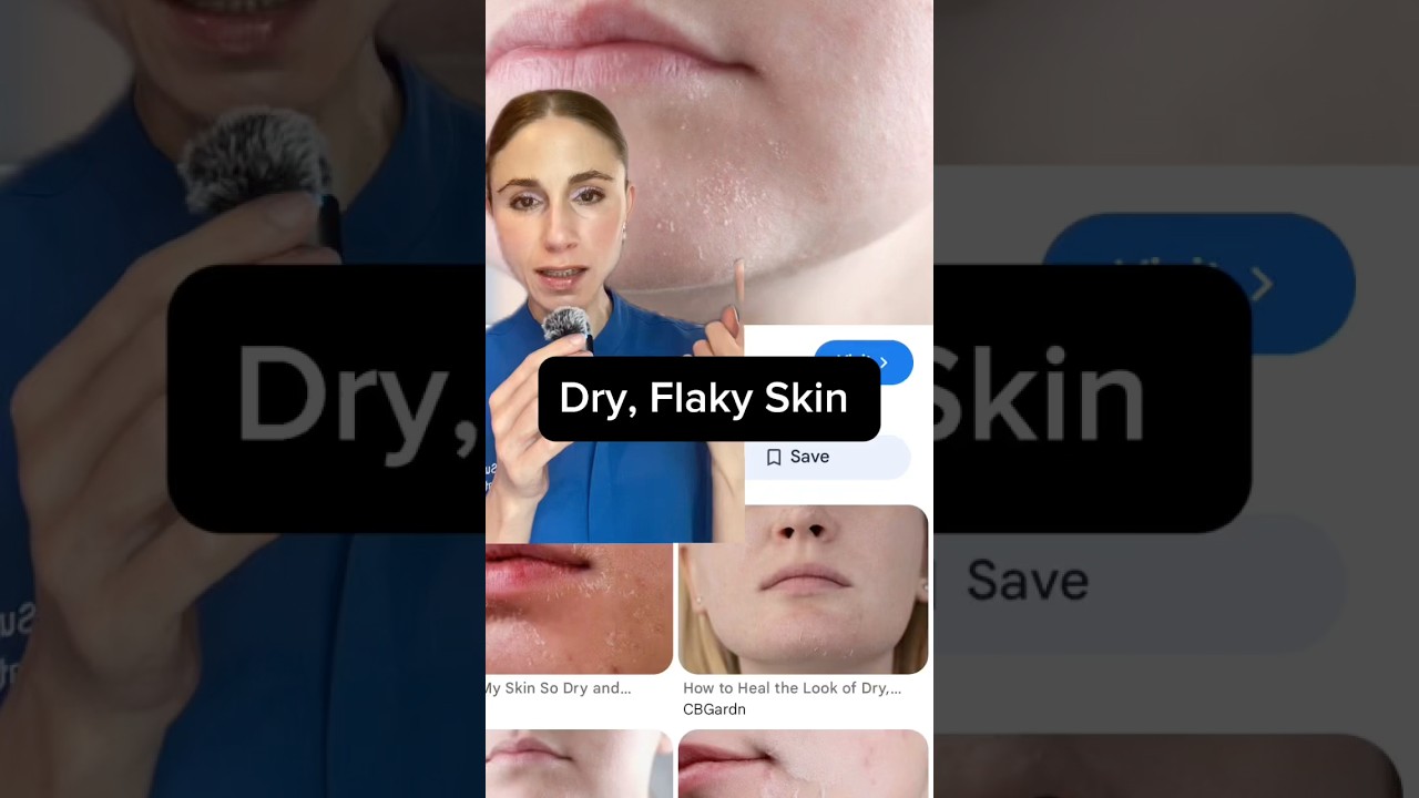 Быстрое решение проблемы сухой и шелушащейся кожи #dermtips