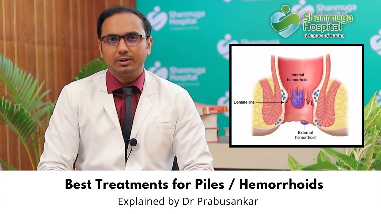 Best treatment for Piles | Explained by Dr Prabusankar | Internal and External Hemorrhoids
