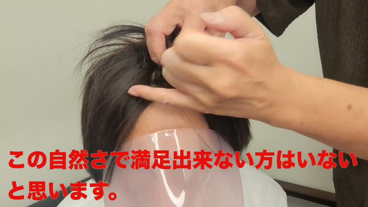 これ以上の自然さがあれば教えて下さい。液体マジックテープと生え際色抜き技術の融合で遂に完璧な生え際が完成。