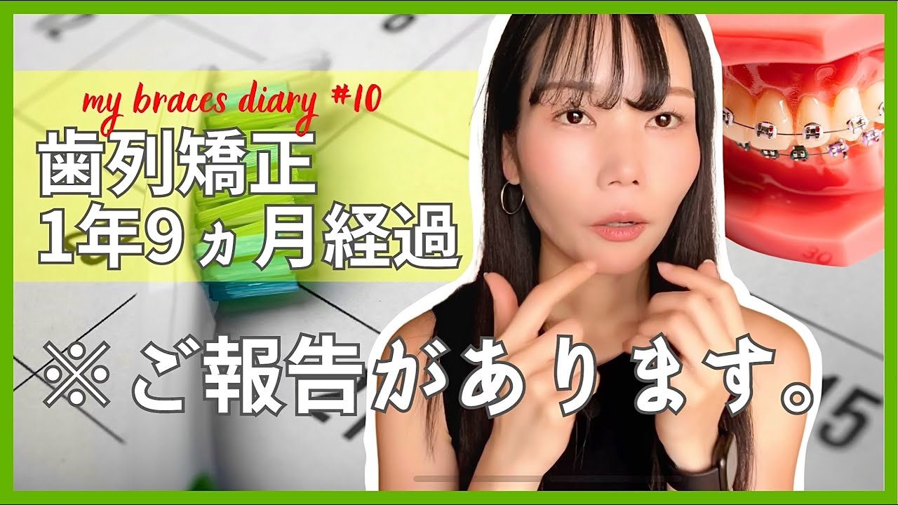 【歯列矯正】1年9カ月目｜ガミースマイルの治療ビフォーアフター