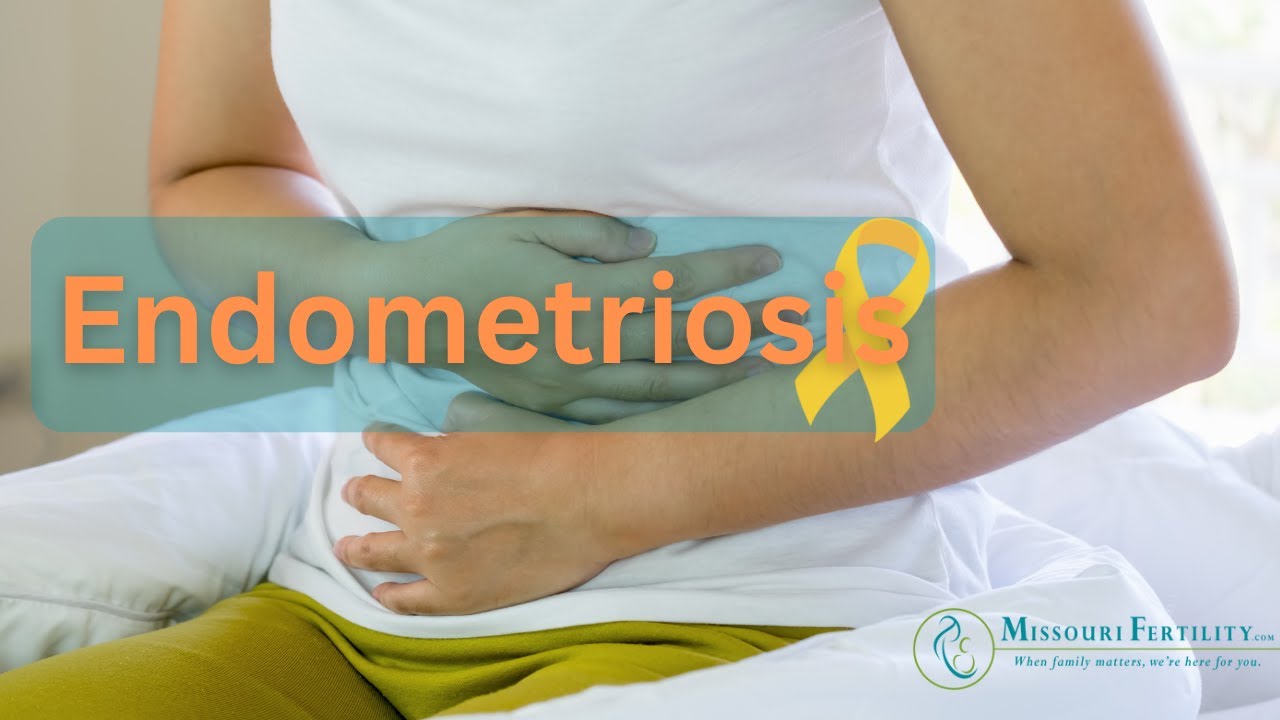 Endometriosis: Does it Cause Infertility?