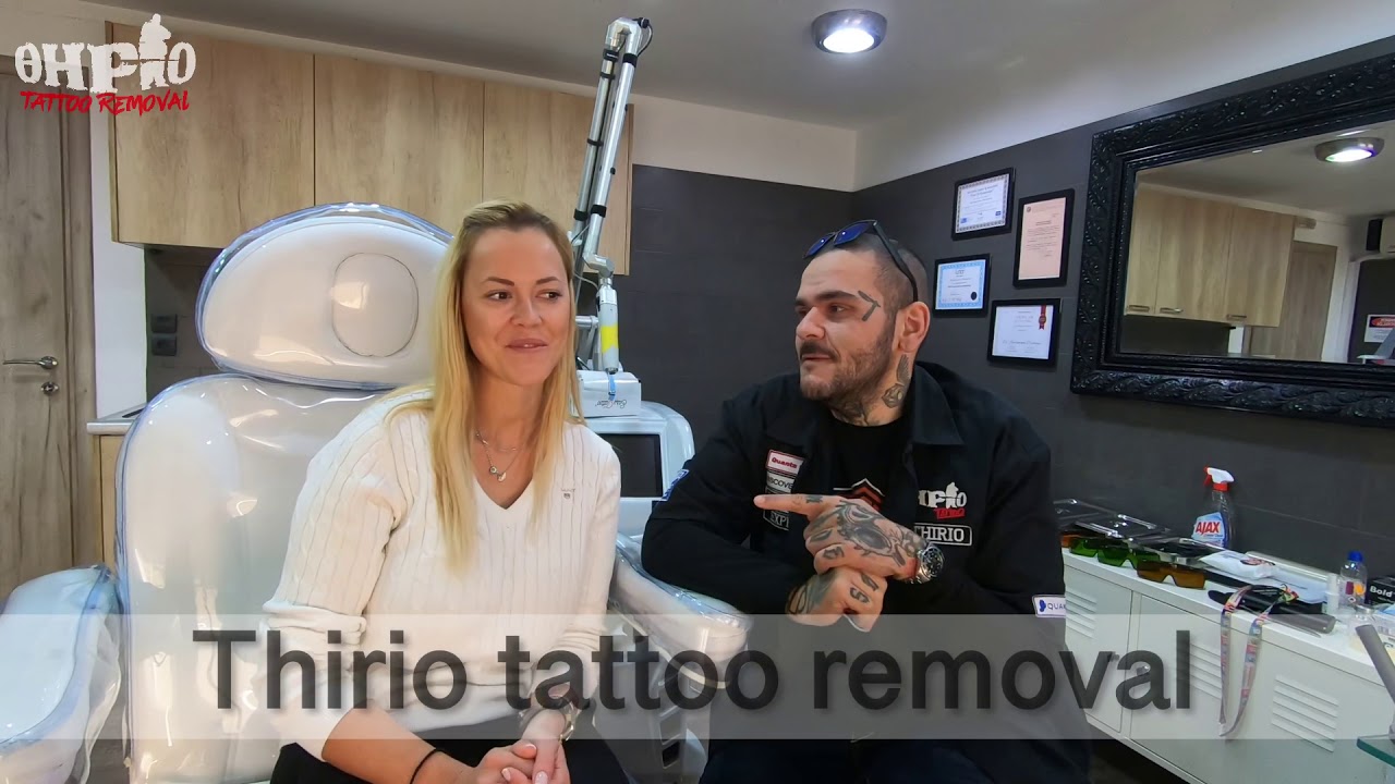 Thirio tattoo removal 