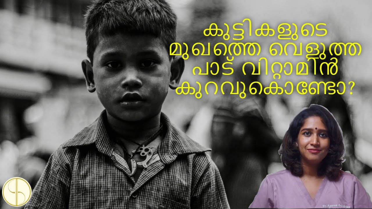 കുട്ടികളുടെ മുഖത്തെ വെളുത്ത പാട് വിറ്റാമിൻ  കുറവുകൊണ്ടോ?