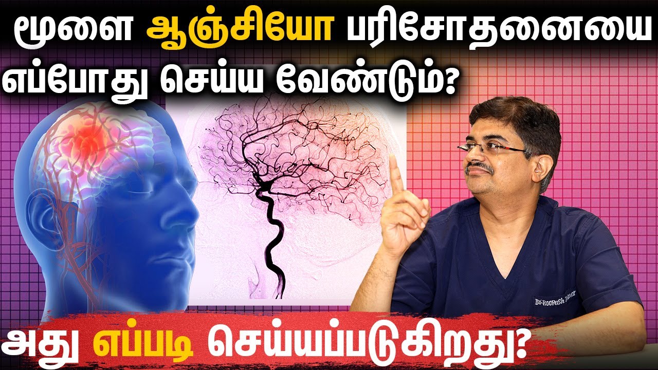 When to do Brain Angio Test? How it's is Done? Dr Roopesh in Tamil