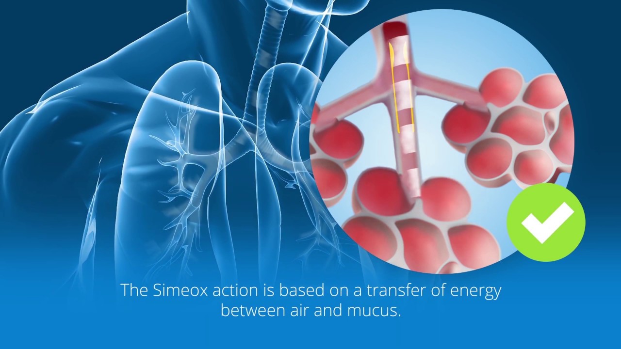 Simeox technology - PhysioAssist - EN