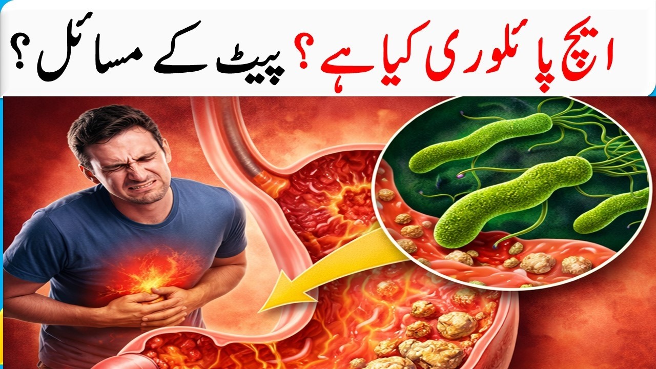 What Is H  Pylori Could This Be the Real Cause of Your Stomach Problems