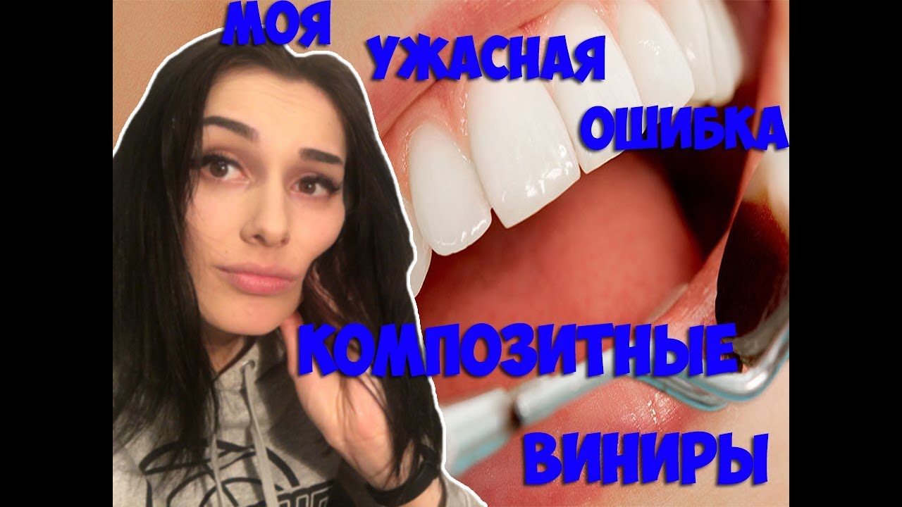 КОМПОЗИТНЫЕ ВИНИРЫ | МОЯ УЖАСНАЯ ИСТОРИЯ ! МОЖНО ЛИ СНЯТЬ КОМПОЗИТНЫЕ ВИНИРЫ ?