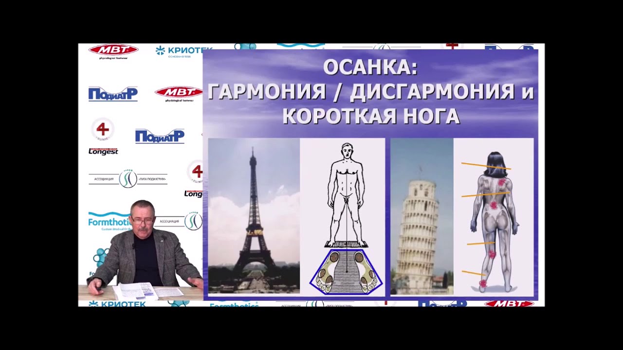 Доктор Нечаев Владимир Ильич. Синдром короткой ноги