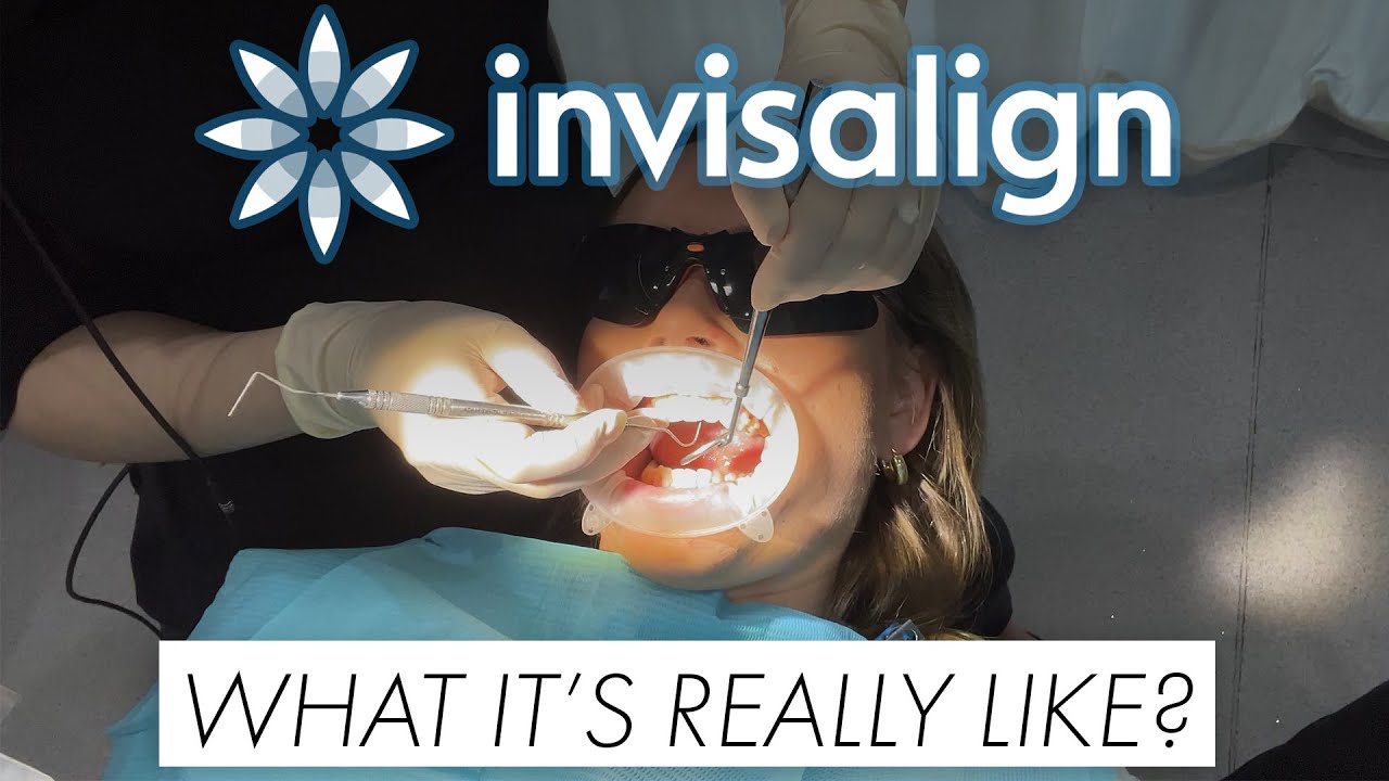 FIRST DAY WITH INVISALIGN - pain, surprising my husband, munchies, tips and more