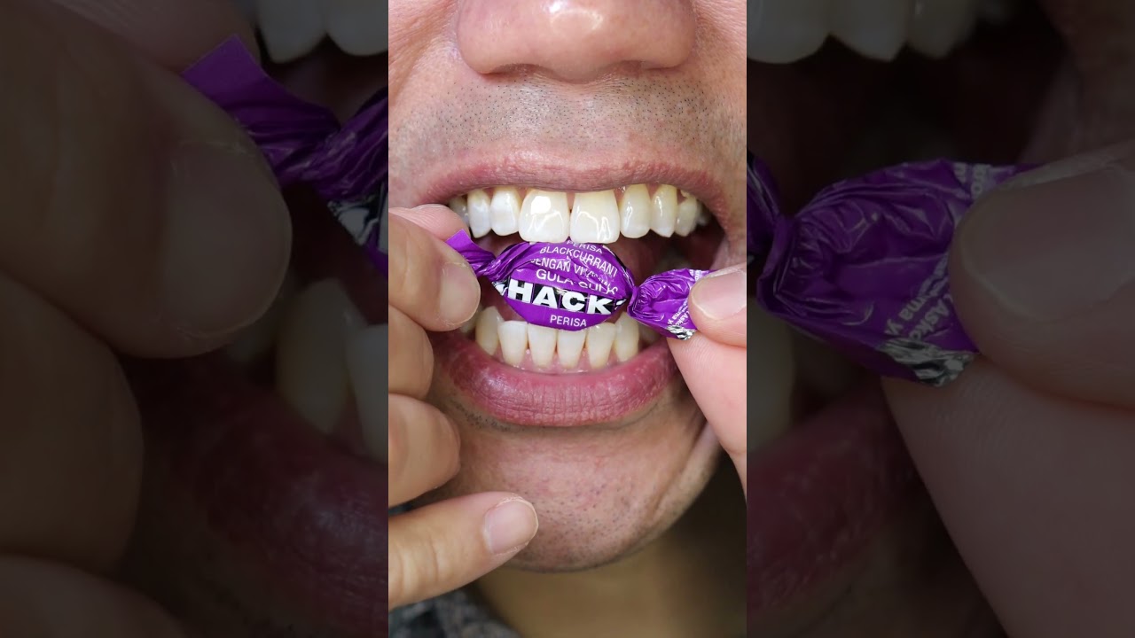 ASMR | HACKS Blackcurrant Candy #DoctorTristanPeh #ASMR #Shorts