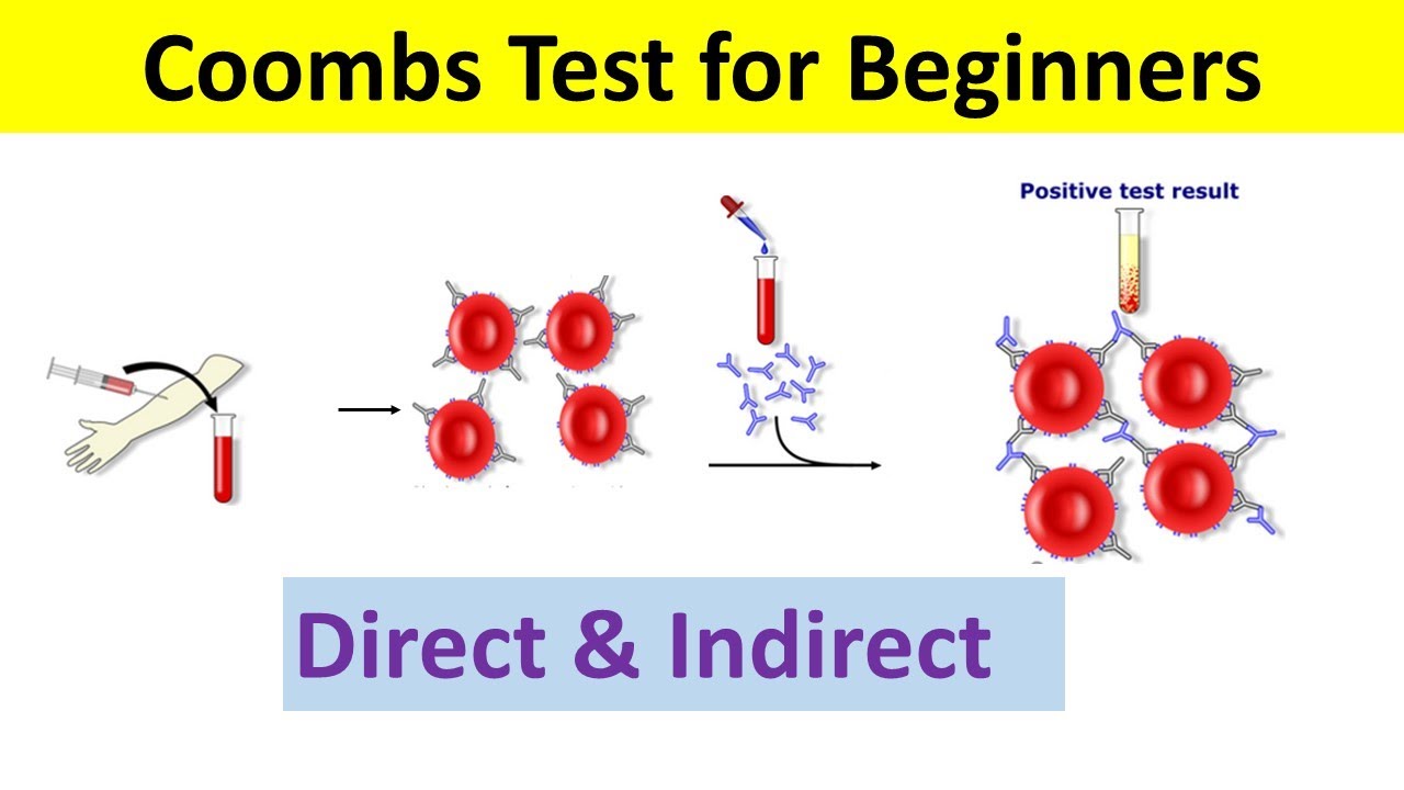 Реакция Кумбса: принцип, типы, процедура, интерпретация | Реакция Кумбса прямая и косвенная