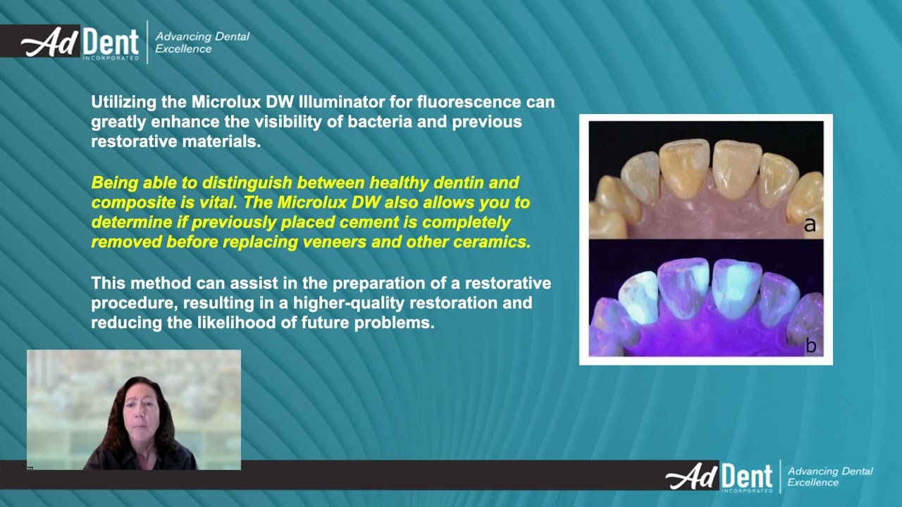 Microlux DW Illuminator - Makes dental evaluations more effective.
