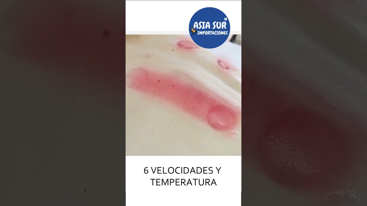 VENTOSA ELECTRICA MASAJEADOR