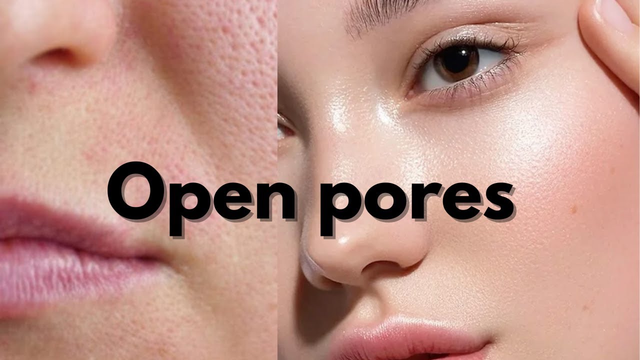 Open Pores remedy at home | How to treat Large open pores | Haleemahomelife