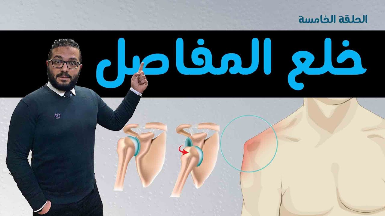 خلع المفاصل | أسبابه  - أنواعه  - أماكن حدوثه  و خطورته | سلسلة إصابات العظام | الحلقة 5