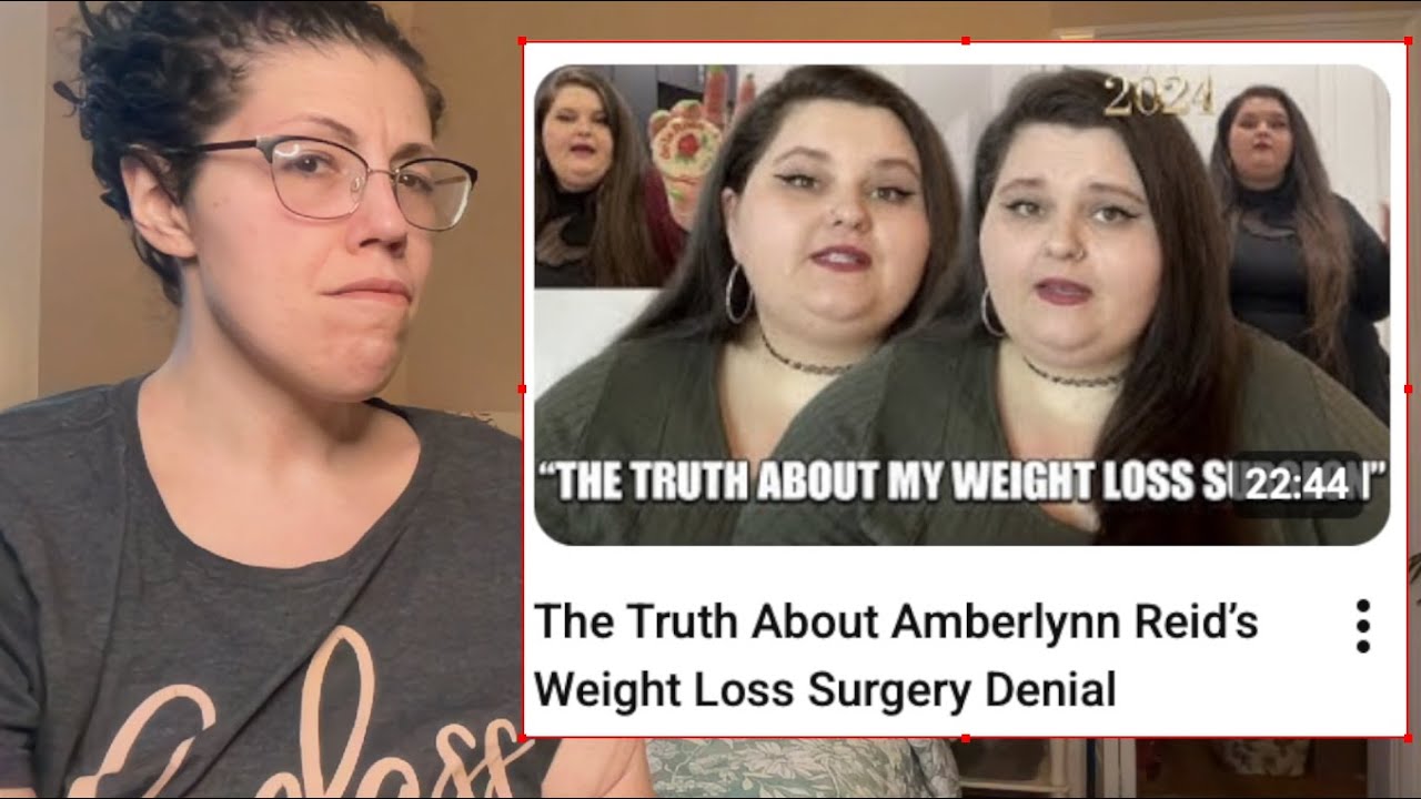 Amber's Infuriating Surgery Grift Revisited *live react*