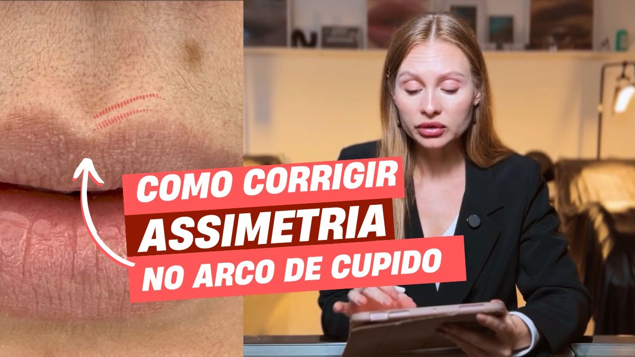 COMO CORRIGIR A ASSIMETRIA NO LÁBIO SUPERIOR/ARCO DE CUPIDO COM MICROPIGMENTAÇÃO - Iana Iefremova