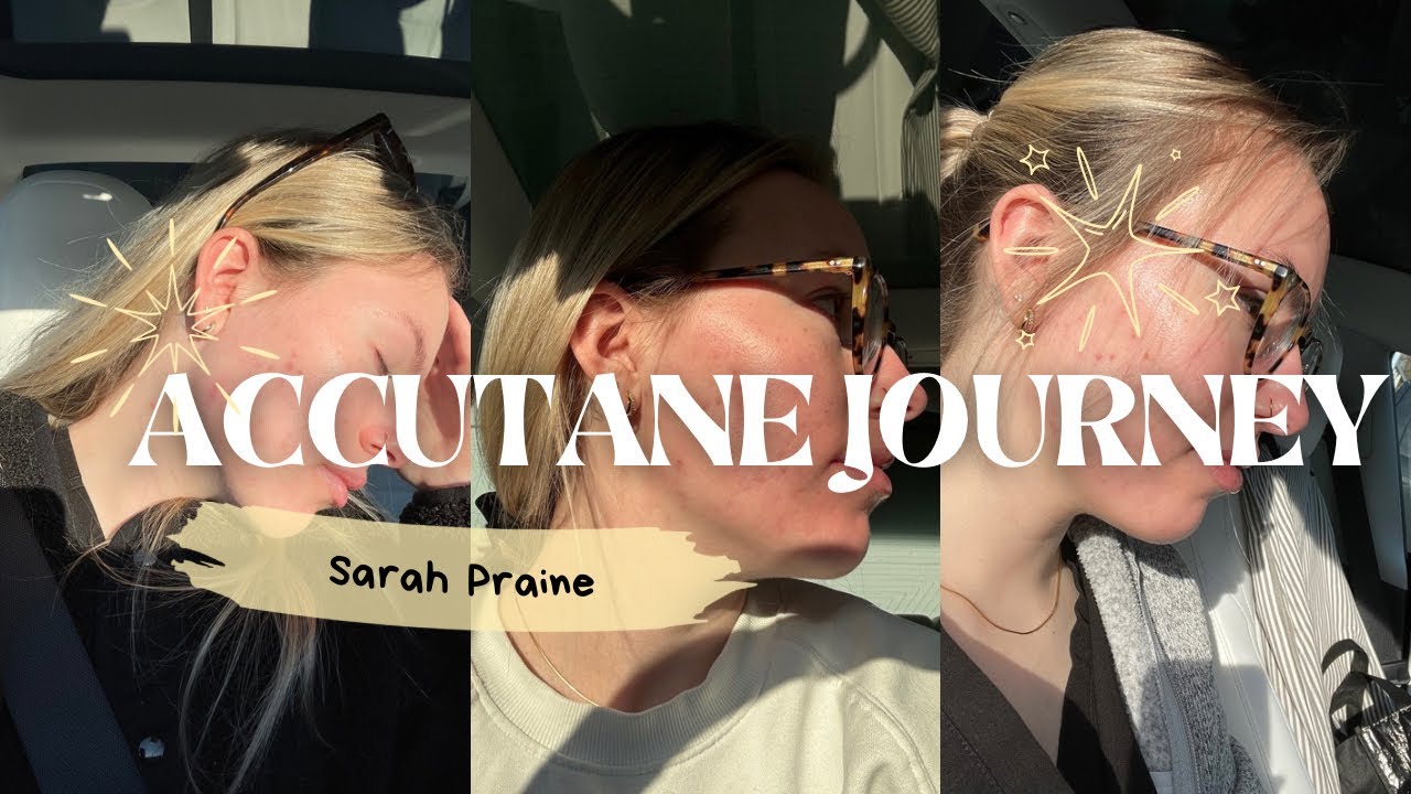 Accutane Journey