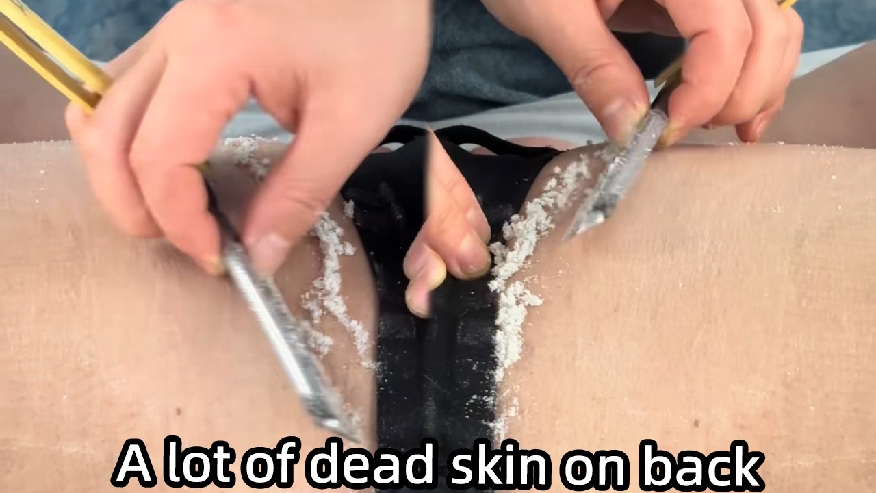 💈Back Shaving！Removes a lot of dead skin！So much dead skin on his back！112