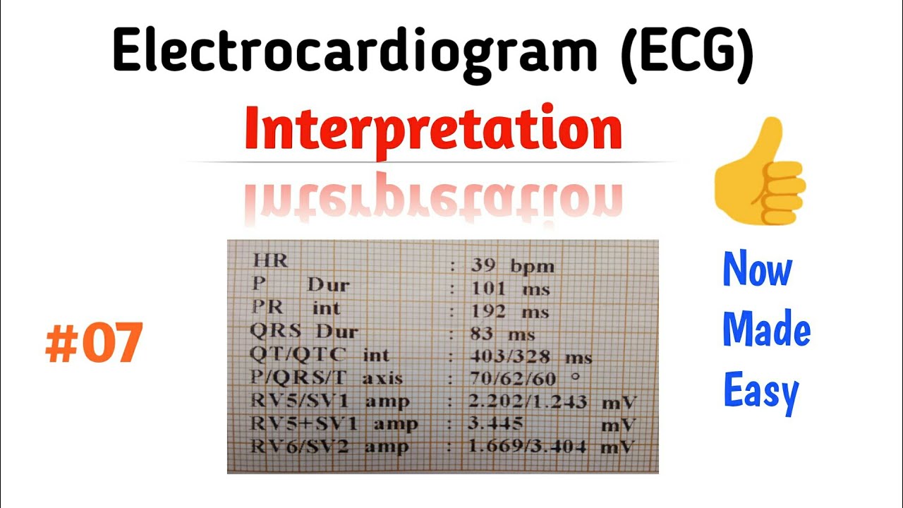 How to Read an ECG (interpretation) | 07 QT/QTc Interval