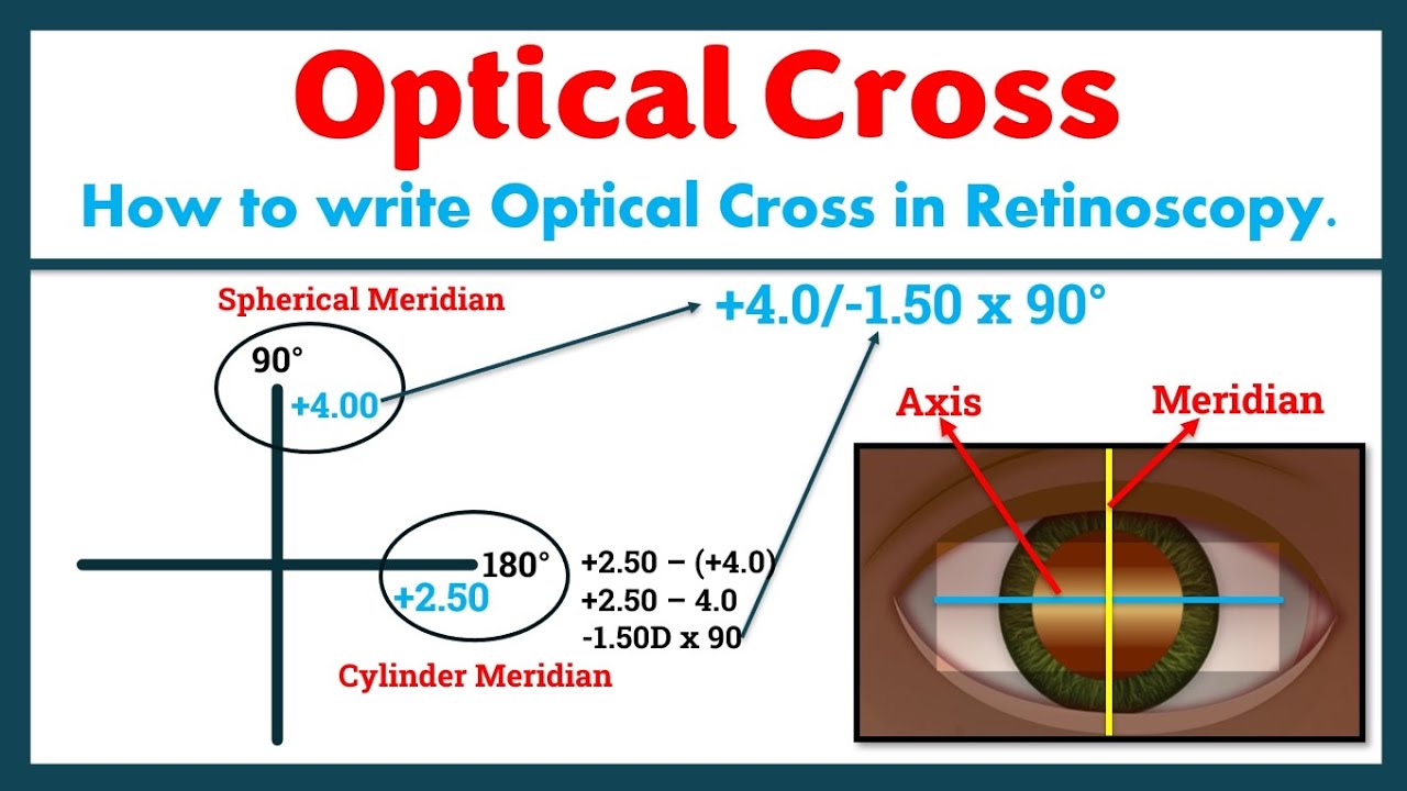 Optical Cross in Refraction