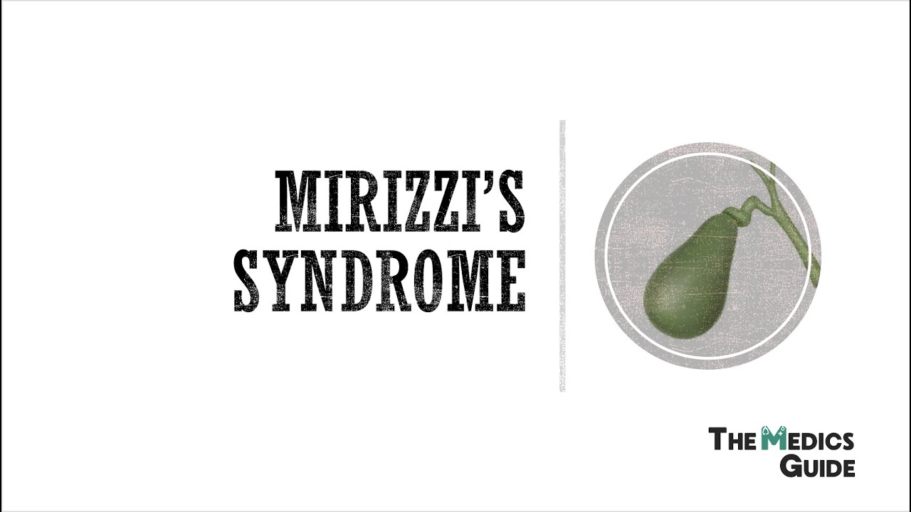 Mirizzi's Syndrome - A Clinical Overview for Medical Students