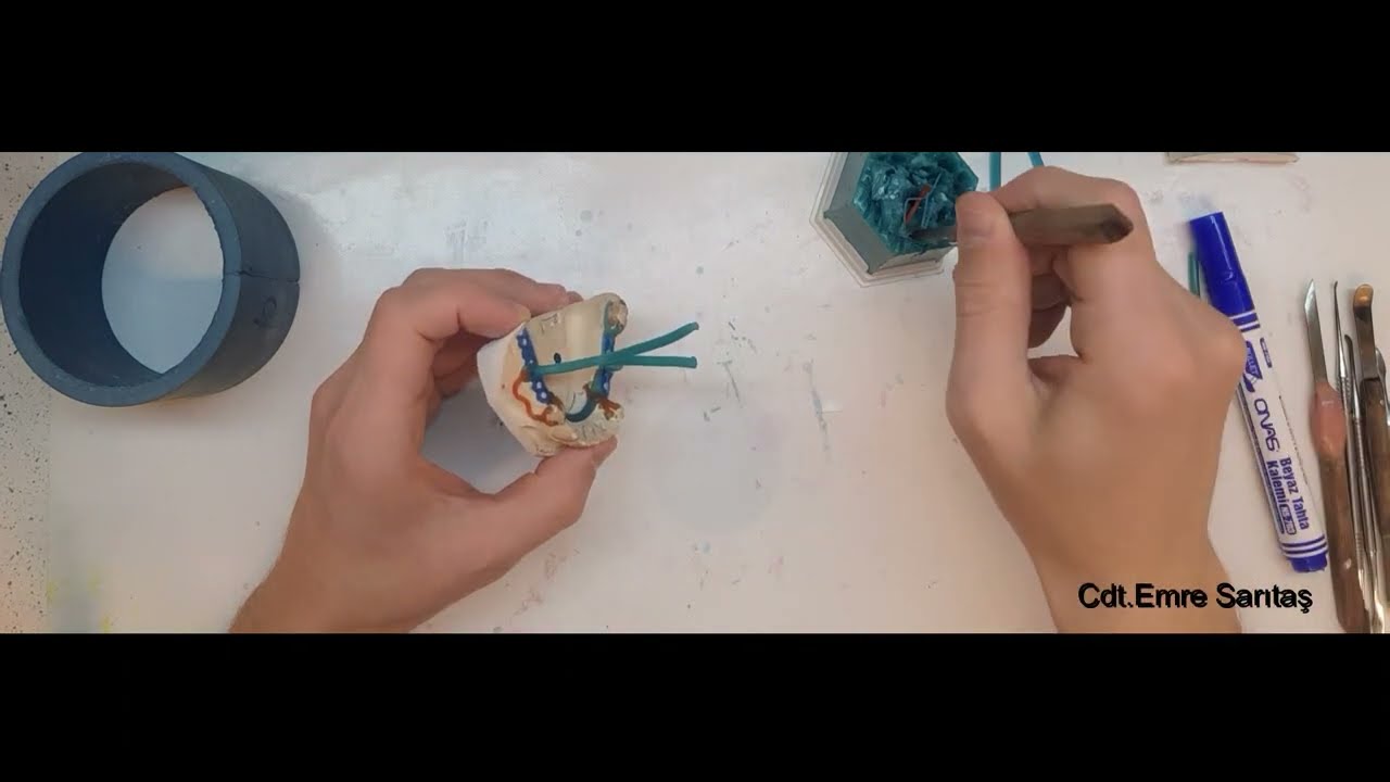 Alt ve Üst Çene İskelet Planlama - Manşete Alma 4