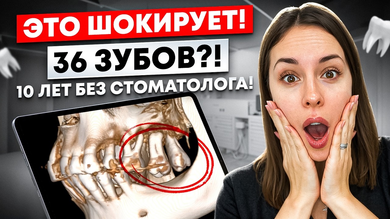 Неожиданные находки в кабинете ортодонта! Ошибки, которые стоят зубов