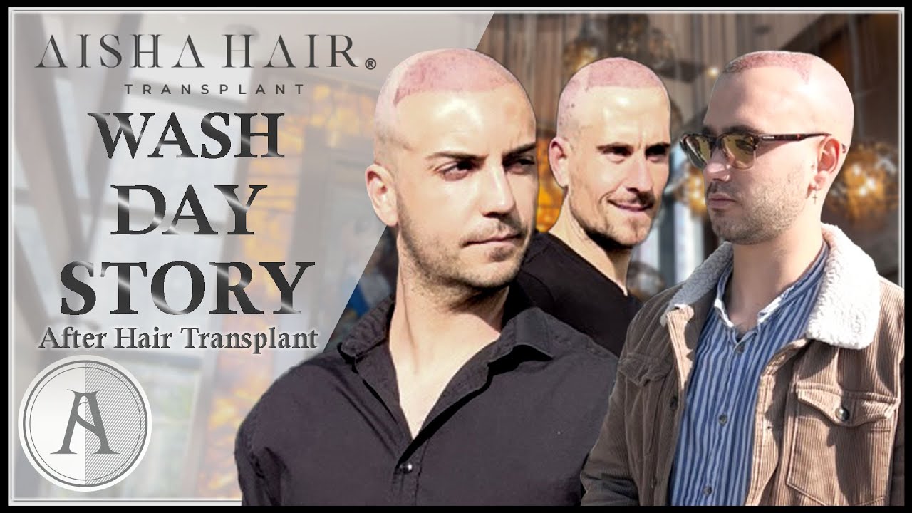 Story Of The Wash Day After Hair Transplantation | Historia dia del Lavado Injerto Capilar