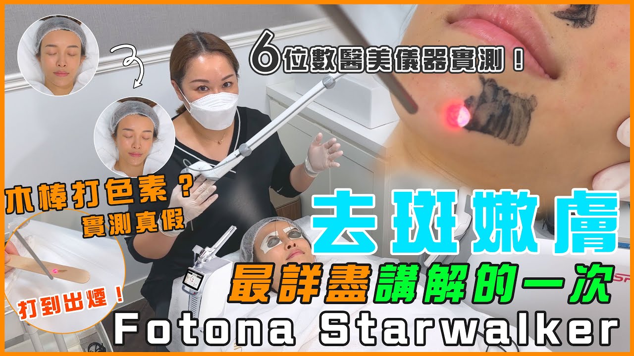 Fotona Starwalker 激光去斑｜想去色斑佢係最好選擇？拆解坊間皮秒/納秒機去斑廣告陷阱！皮秒、納秒、Q-switch、Pico又是什麼？最詳盡講解的一次！#medskinHK