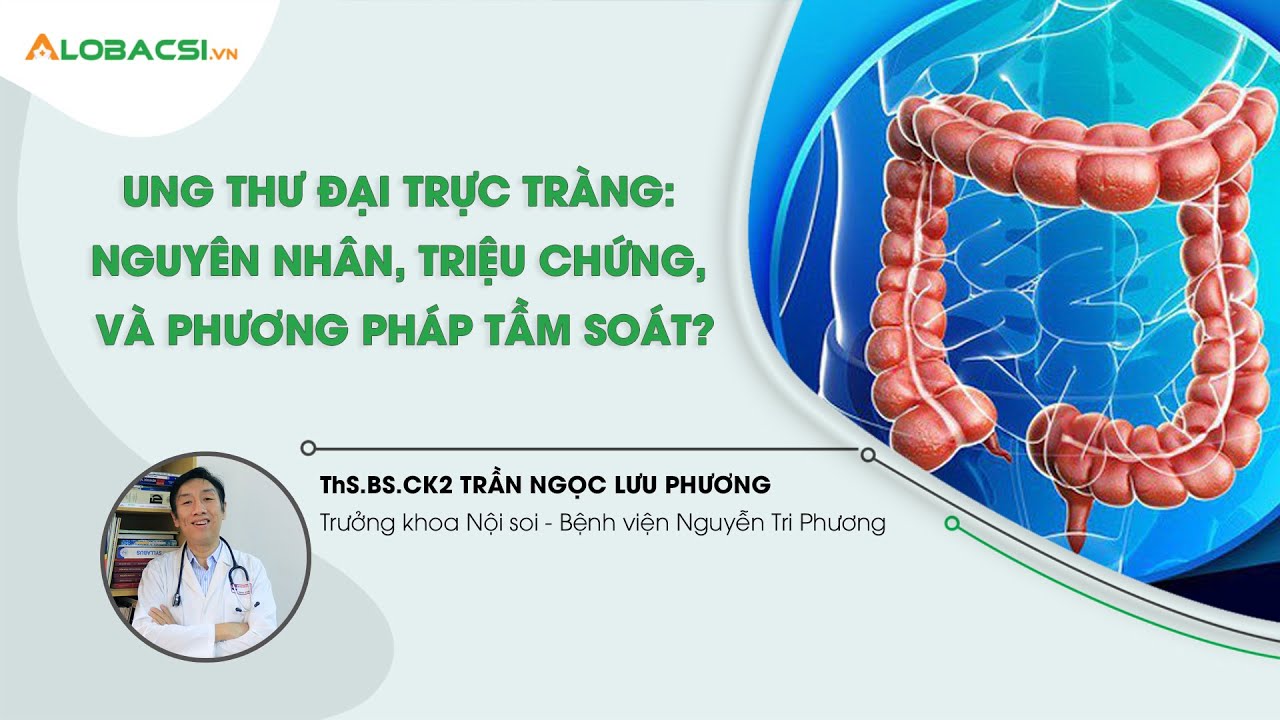 Ung thư đại trực tràng: Nguyên nhân, triệu chứng, điều trị và phương pháp tầm soát?