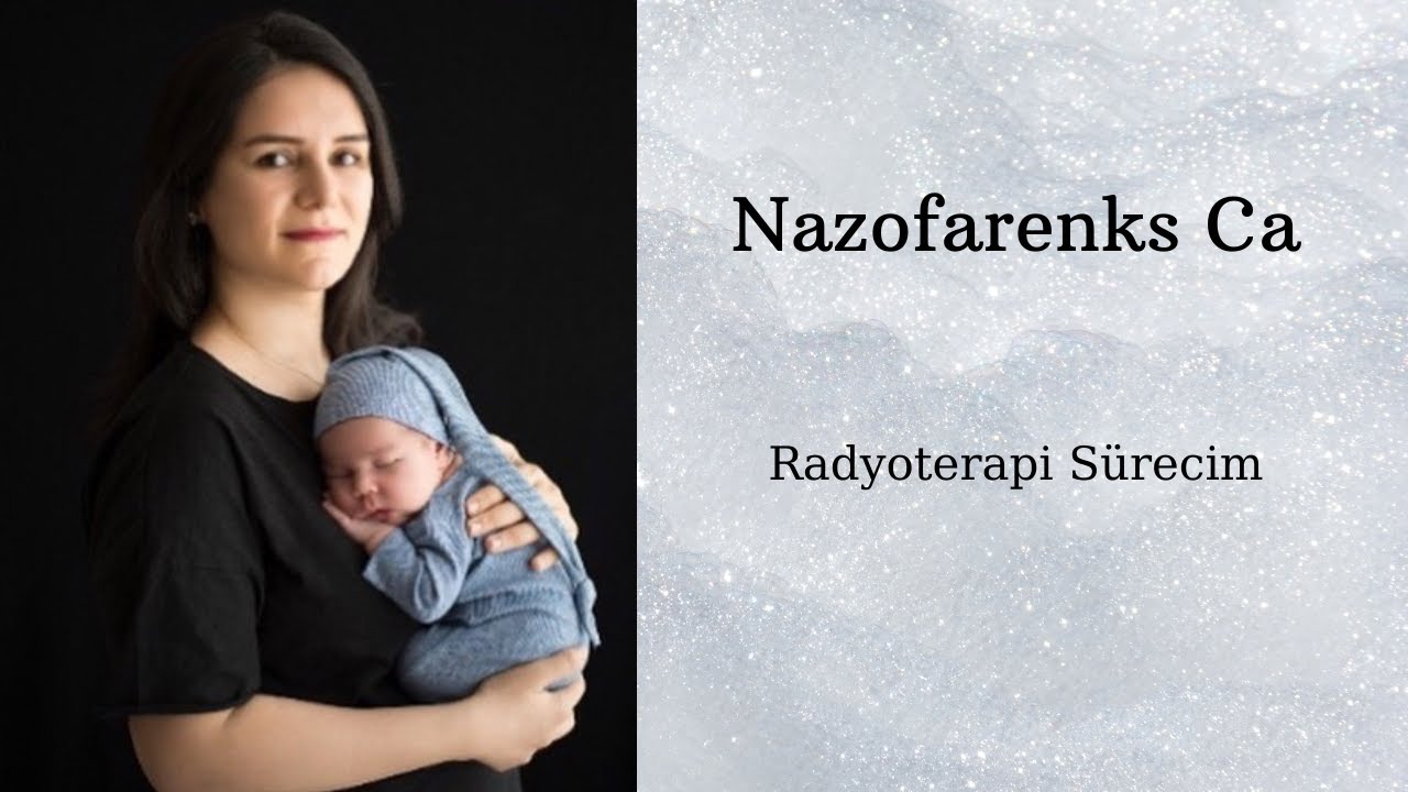 RADYOTERAPİ IŞIN TEDAVİSİ / RADYOTERAPİ HAZIRLIKLARI / RADYOTERAPİ YAN ETKİLERİ / NAZOFARENKS CA