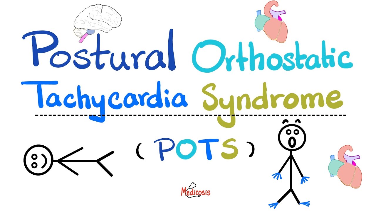 Postural Orthostatic Tachycardia Syndrome (POTS) - Causes, Symptoms, Diagnosis, Treatment-Cardiology