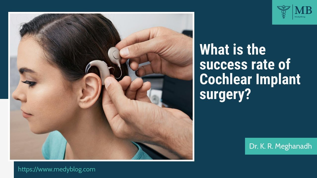 What is the success rate of a cochlear implant? | Dr. K. R. Meghanadh | Medyblog