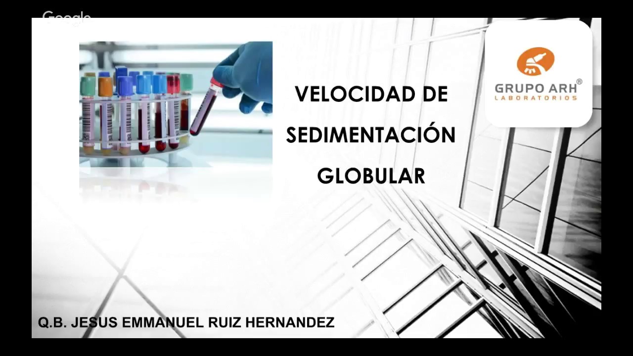 Velocidad de eritrosedimentación y su importancia.