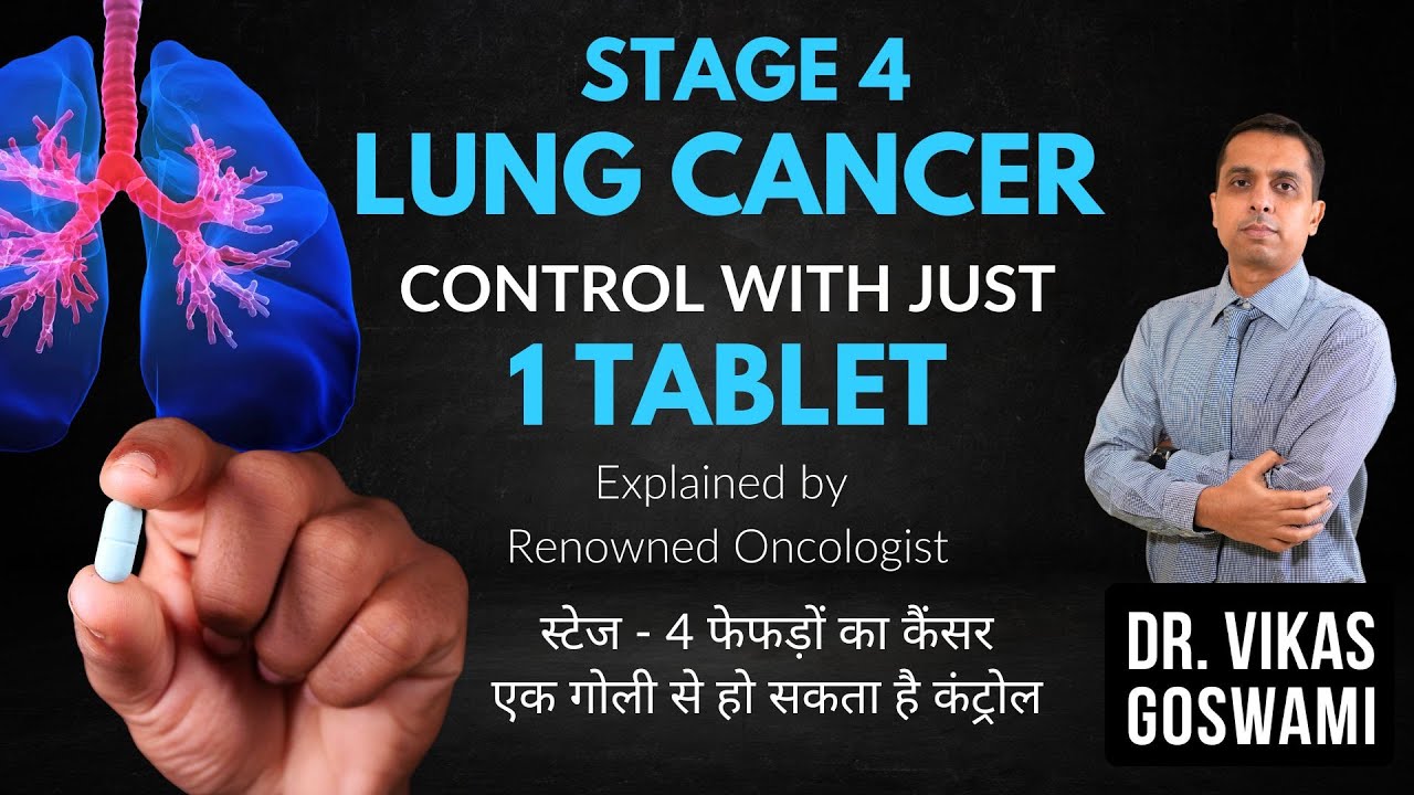 4th stage Lung Cancer - 1 Tablet treatment - Dr. Vikas Goswami - फेफड़ों का कैंसर एक गोली से कंट्रोल